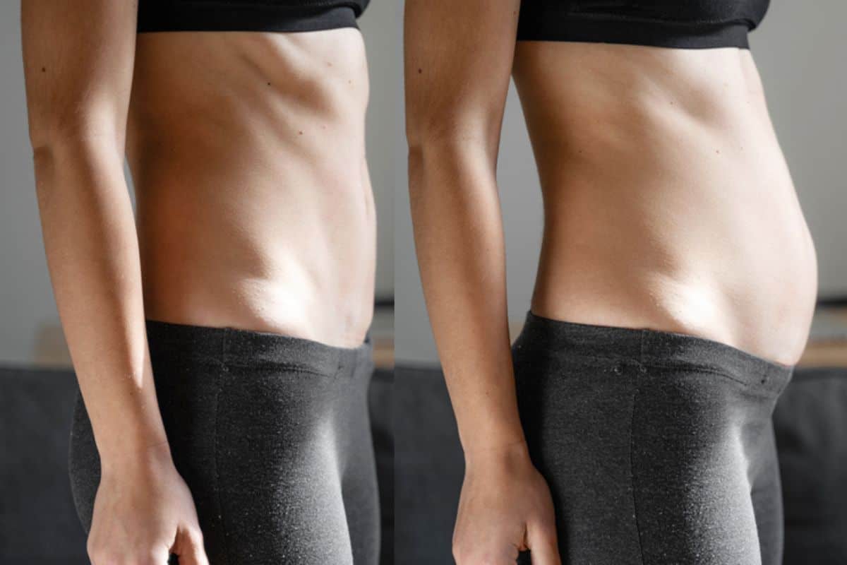 How long does diastasis recti take to improve Chandler's Ford?