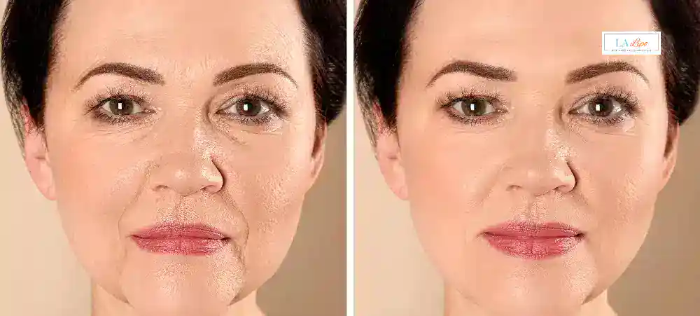 Why Aren’t My Skincare Products Making My Sagging Skin Look Firmer Chandler's Ford?